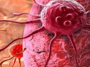 Begini Gejala Utama Tumor Pada Anak, Yuk Simak!