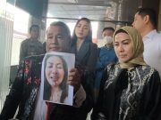 Akibat KDRT, Tulang Rusuk Venna Melinda Retak dan Alami Gangguan Psikologis!