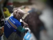 Dinkes Surabaya Monitoring Kesehatan Pasien Obesitas di Surabaya Pascaoperasi