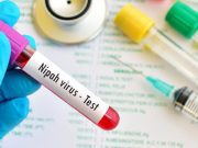 Waspada Virus Nipah, Kurangi Risiko Penularannya dengan Cara Ini
