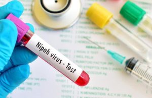 Waspada Virus Nipah, Kurangi Risiko Penularannya dengan Cara Ini