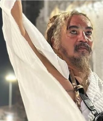 Limbad Ditahan Imigrasi Jeddah karena Gigi Taring Permanen